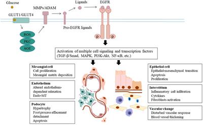 Epidermal Growth Factor Receptor: A Potential Therapeutic Target for Diabetic Kidney Disease